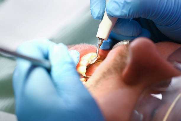 Best Emergency TMJ Treatment in Oak Ridge, NJ