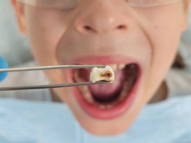 Best Emergency Denture Repair in Oak Ridge, NJ