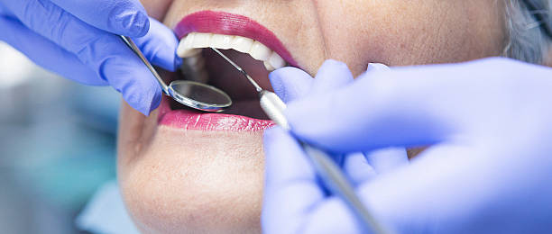 Best Emergency Treatment for Dental Infections or Abscesses in Oak Ridge, NJ